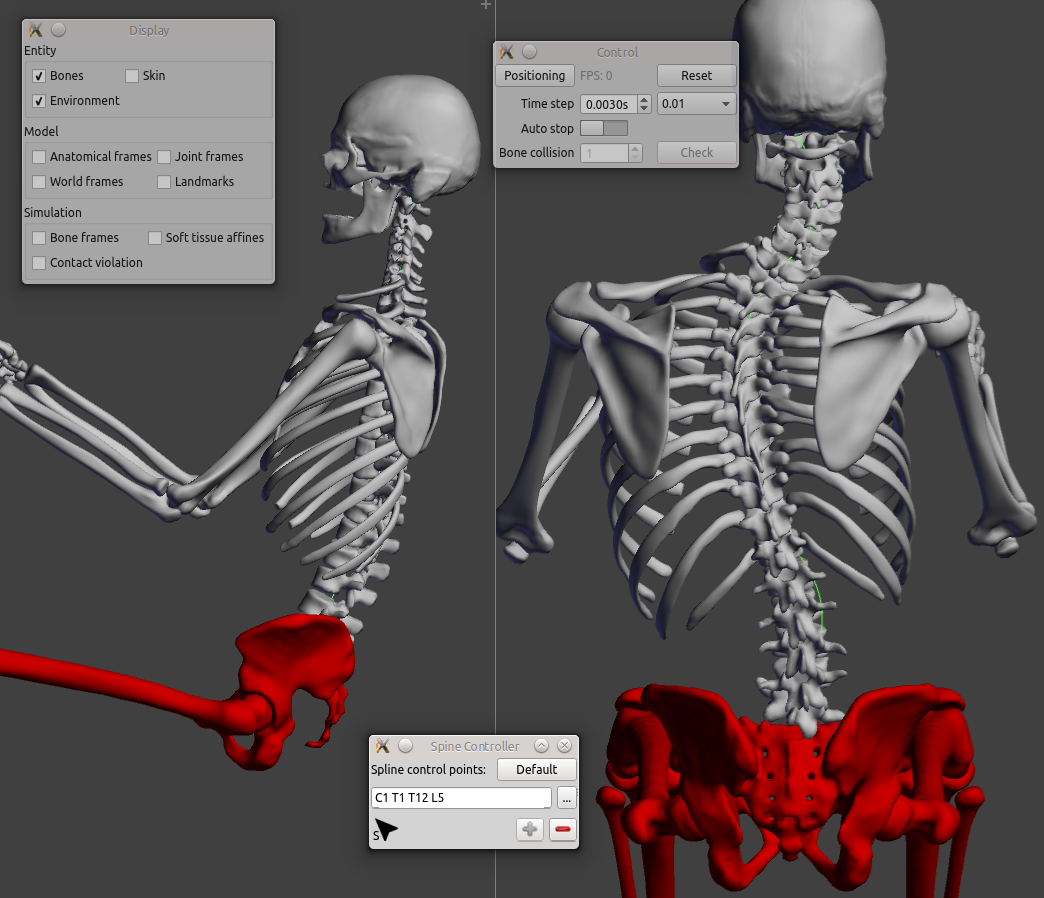 workflow_positioningSpinePrediction_sceenshot03.png