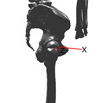 HipLat.png