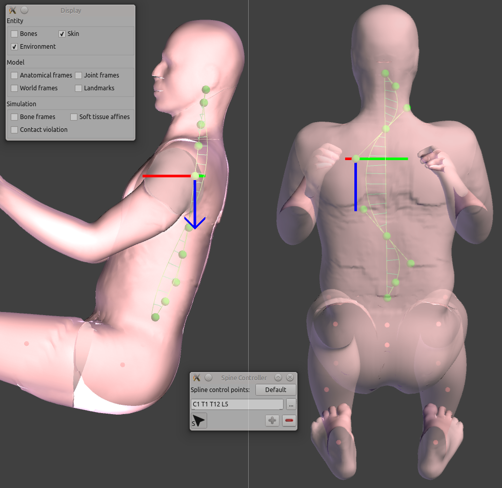 workflow_positioningSpinePrediction_sceenshot02.png